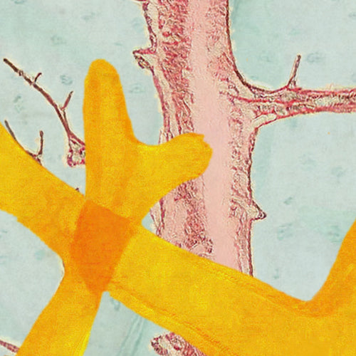 Komar NEU | Digitaldruck Vlies Fototapete - Catchy Corals - Größe 200 x 250 cm